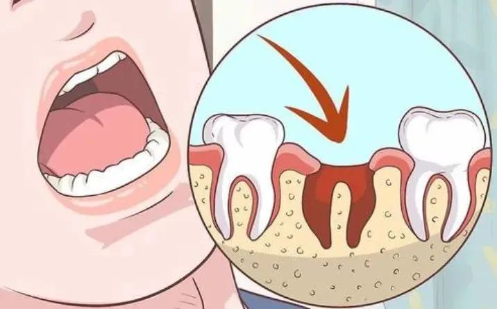 微肽生物-口腔科专用-壳聚糖口腔止血海绵